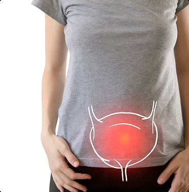 Bladder pain and urinary discomfort illustration